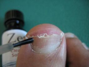 Aplicar laca