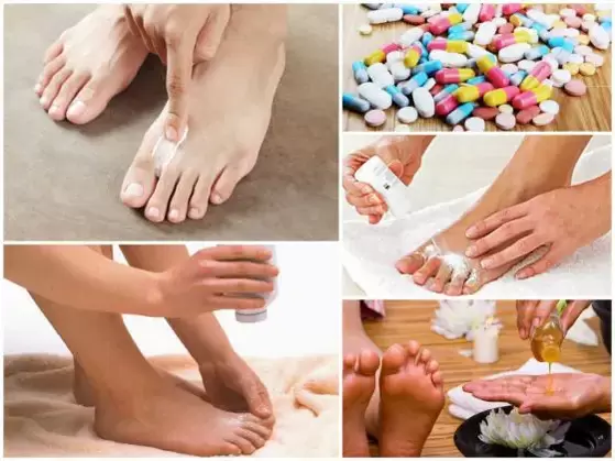 Formas de tratar los hongos entre los dedos de los pies.