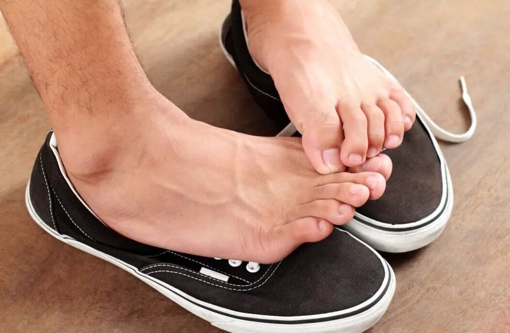 Picazón en los pies debido a un hongo entre los dedos.
